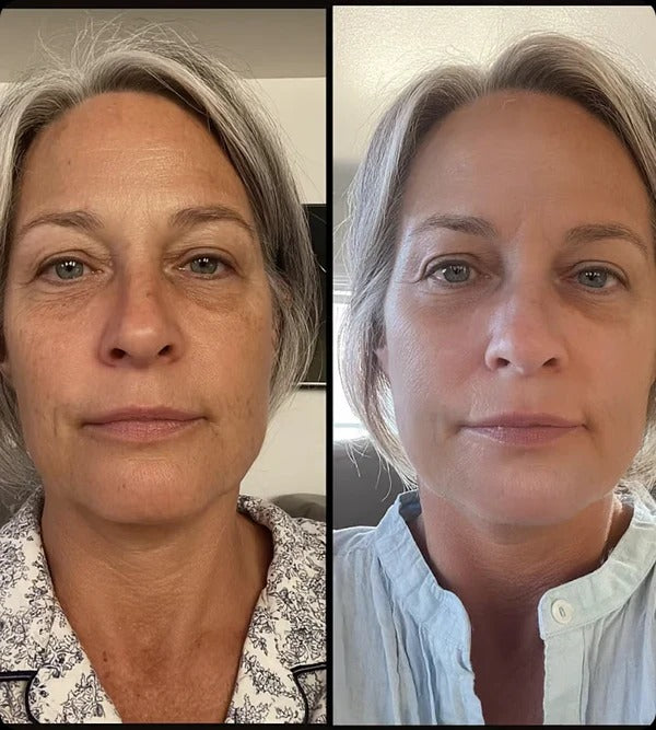 6 anledningar till varför kvinnor över 40 säger upp sina filler-tider för Svea Skin PDRN Collagen Volume Balm
